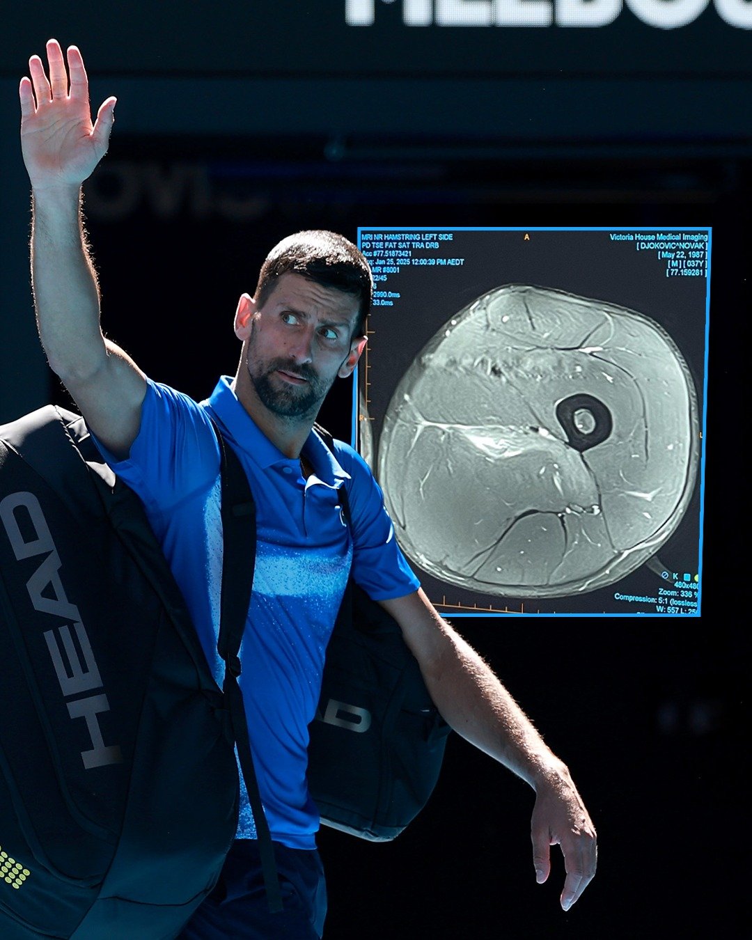 德约科维奇官方宣布反败为胜新规，切尔西引发争议！